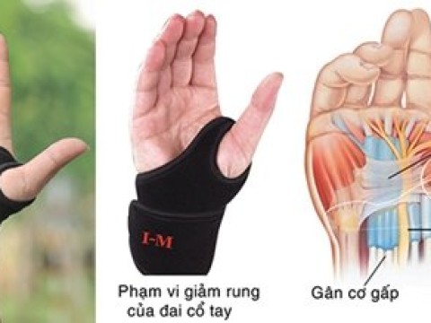 Nguyên nhân và cách chữa trị chấn thương khớp cổ tay